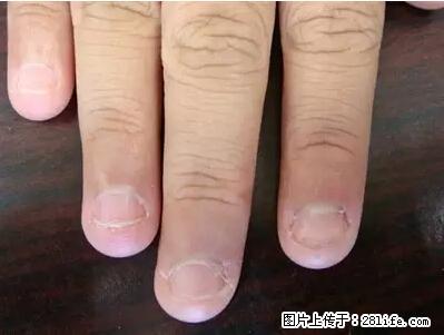 剪指甲、挖耳屎，这些日常小动作竟隐藏大危害！ - 湛江生活资讯 - 湛江28生活网 zhanjiang.28life.net